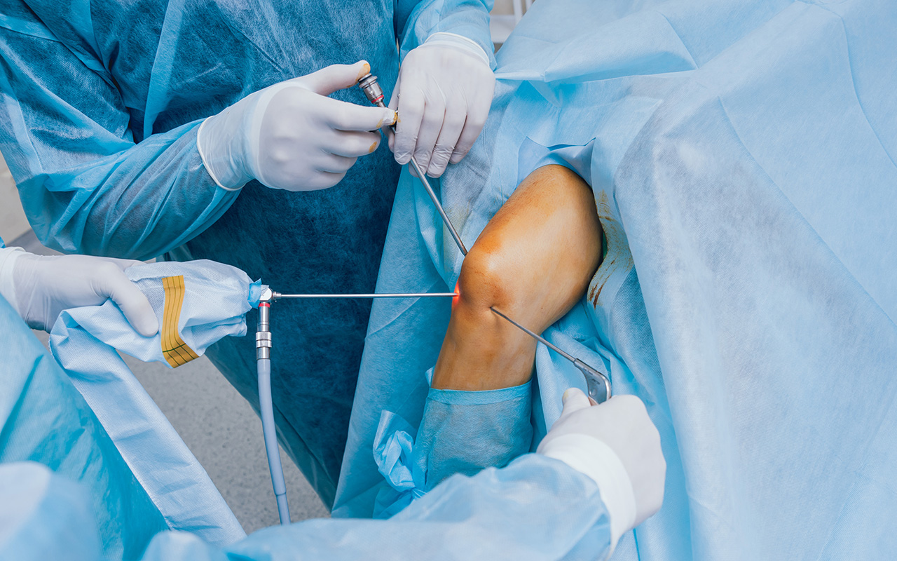 Закрытая хирургия коленного сустава
